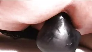 Uso irracional del culo